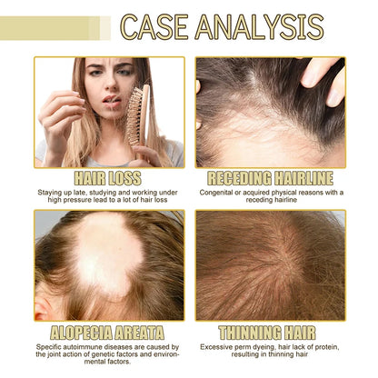 EELHOE Thrive Hair Regrowth