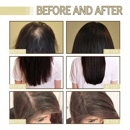 EELHOE Thrive Hair Regrowth